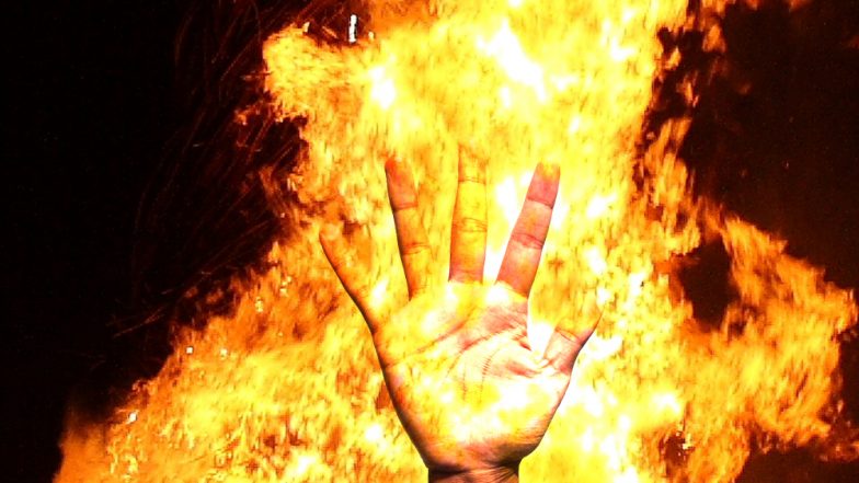 मोबाइल को लेकर हुआ झगड़ा तो 3 दोस्तों ने पेट्रोल डालकर अपने दोस्त को जलाया, पीड़ित की हालत गंभीर 