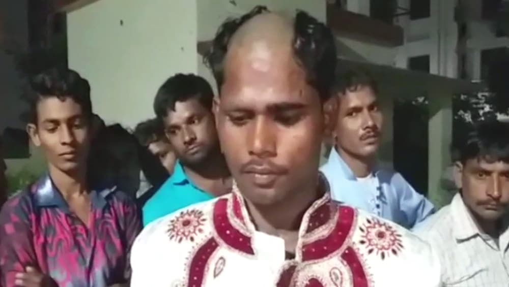 यूपी: बाइक और सोने की चेन मांगने पर लड़की वालों ने दूल्हे का सिर मुंडवा दिया
