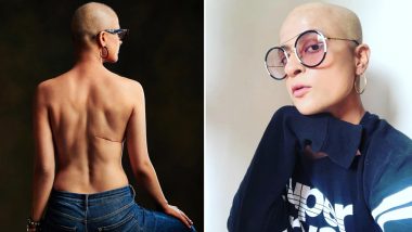 कैंसर से पीड़ित ताहिरा कश्यप ने विश्व कैंसर दिवस पर शेयर की ऐसी तस्वीर, हालत देखकर फैंस भी हुए हैरान
