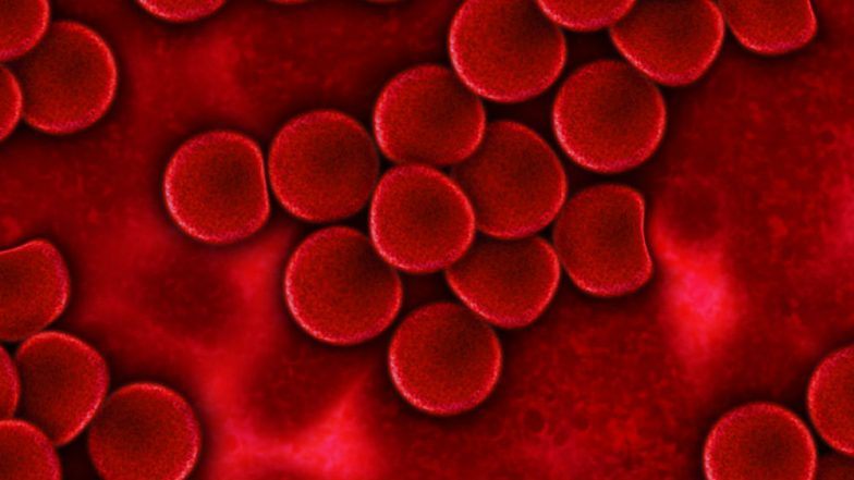 World Hemophilia Day 2019: महिलाओं से ज्यादा पुरुषों को होता है हीमोफीलिया का खतरा, जानिए इसके लक्षण, प्रकार और बचाव के उपाय