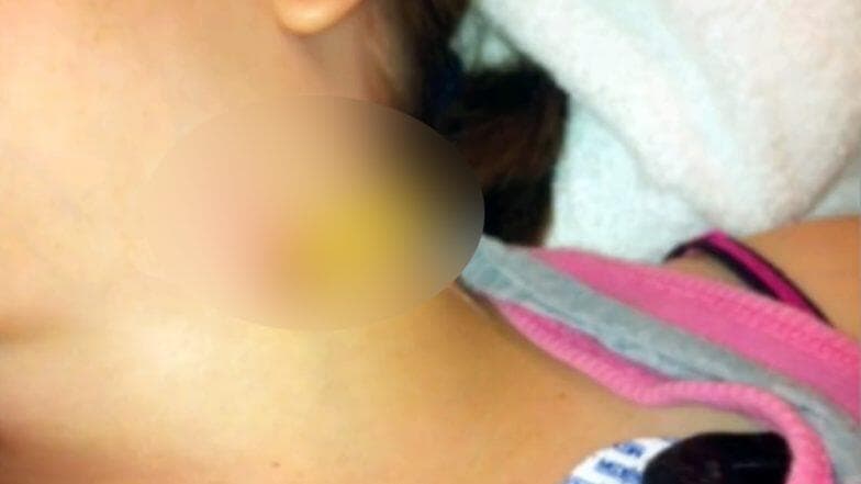 टोरंटो के एक स्कूल में खेलते समय 11 साल की बच्ची के गले में अटकी पेन्सिल, देखें हैरान करने वाला वीडियो टोरंटो के एक स्कूल में खेलते समय 11 साल की बच्ची के गले में अटकी पेन्सिल, देखें हैरान करने वाला वीडियो