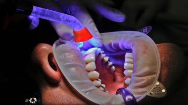 दांतों की वजह से भी हो सकता है जीभ का कैंसर, जानें लक्षण और सुझाव