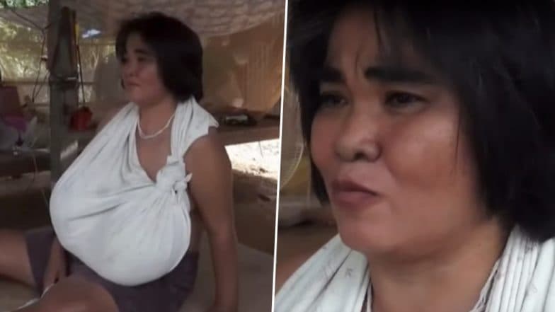 तेजी से बढ़ते जा रहे हैं इस महिला के Boobs, चलने के लिए बैसाखी का लेना पड़ता है सहारा, देखें वीडियो तेजी से बढ़ते जा रहे हैं इस महिला के Boobs, चलने के लिए बैसाखी का लेना पड़ता है सहारा, देखें वीडियो