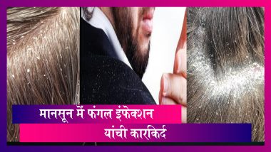 Fungal Infection In Hair – Latest News Information in Hindi | ताज़ा ख़बरें,  Articles & Updates on Fungal Infection In Hair | Photos & Videos | लेटेस्टली