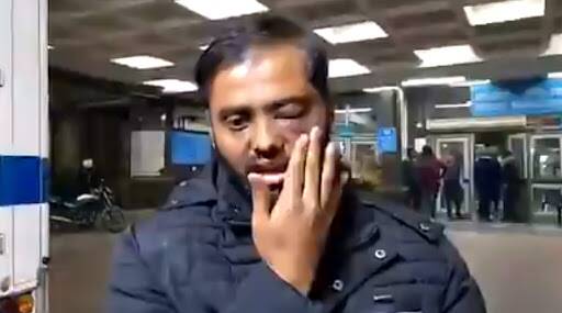 CAA के खिलाफ विरोध प्रदर्शन के दौरान जामिया मिलिया के छात्र की कथित तौर पर पिटाई, पीड़ित ने खो दी अपनी एक आंख की रोशनी