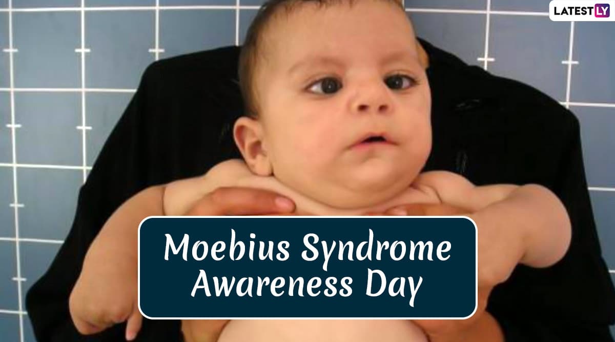Moebius Syndrome Awareness Day 2020: क्या है मोबियस सिंड्रोम, जानें दुर्लभ न्यूरोलॉकिल स्थिति के प्रति जागरूकता के इस दिवस का महत्व और इतिहास Moebius Syndrome Awareness Day 2020: क्या है मोबियस सिंड्रोम, जानें दुर्लभ न्यूरोलॉकिल स्थिति के प्रति जागरूकता के इस दिवस का महत्व और इतिहास