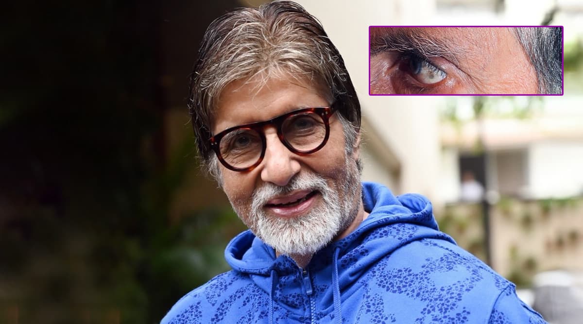 अमिताभ बच्चन को आंख में हुई ये दिक्कत, महानायक ने फोटो शेयर करके लिखा ये इमोशनल मैसेज अमिताभ बच्चन को आंख में हुई ये दिक्कत, महानायक ने फोटो शेयर करके लिखा ये इमोशनल मैसेज
