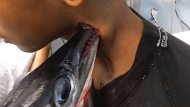 फिशिंग के दौरान इंडोनेशियाई टीनेजर पर नीडलफिश ने किया हमला, गर्दन के आरपार हुई मछली