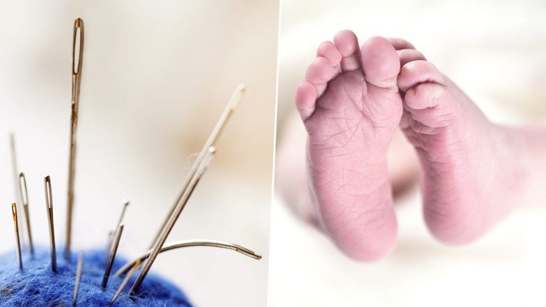 दर्द से रोज तड़पता था 3 साल का बच्चा,  X Ray कराने पर प्राइवेट पार्ट के पास दिखी 11 नुकीली सुइयां- मां-बाप को इस बात का है शक