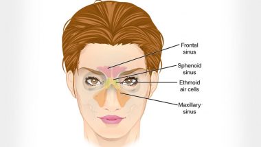 क्या आप साइनस से पीड़ित हैं? इस समस्या से निजात पाने के लिए आजमाएं ये 5 कारगर उपाय