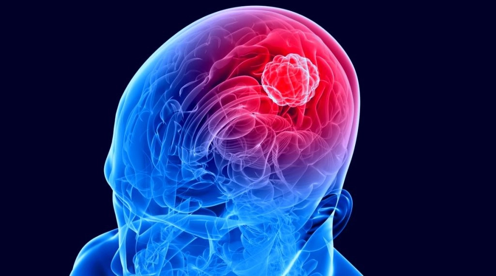 कोरोना वायरस संक्रमण की वजह से मस्तिष्क क्षमता हो सकती है प्रभावित