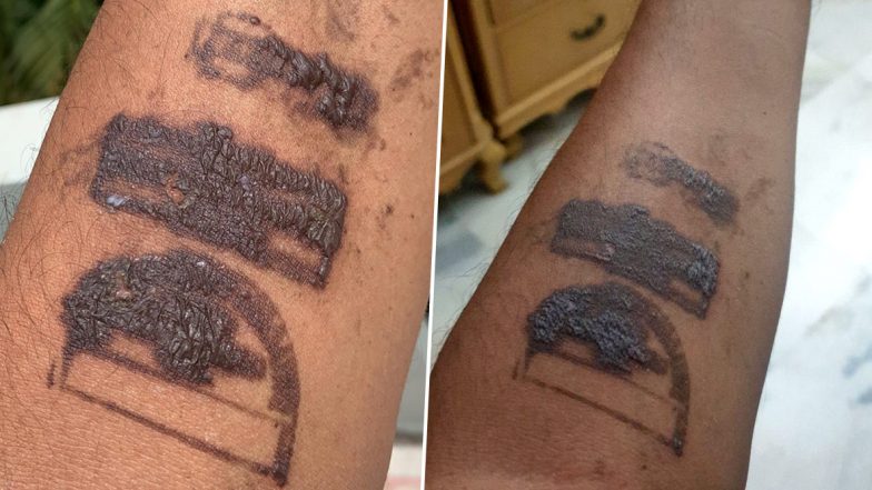 एयरपोर्ट पर लगाए गए क्वारंटीन स्टैंप से पूर्व सांसद मधु गौड़ याक्षी के हाथ पर पड़े काले निशान, केंद्रीय उड्डयन मंत्री से ट्वीट पर की शिकायत
