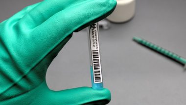 COVID-19 Vaccine: वैज्ञानिकों ने विकसित की वैक्सीन, 10 गुना अधिक मजबूत एंटीबॉडी का उत्पादन करने में सक्षम