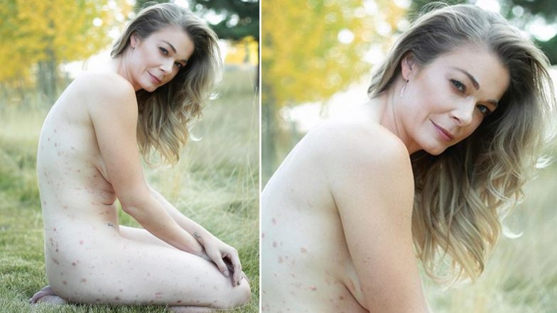 अमेरिकी एक्ट्रेस LeAnn Rimes ने शेयर की अपनी Nude Photo, सोरायसिस की बीमारी का किया खुलासा! देखें Photo