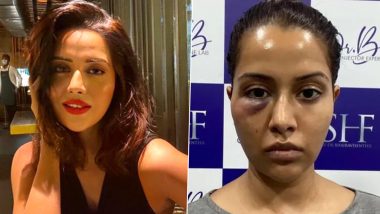तमिल एक्ट्रेस Razia Wilson को फेस सर्जरी करवाना पड़ा भारी, खूबसूरत चेहरे का हुआ ऐसा हाल