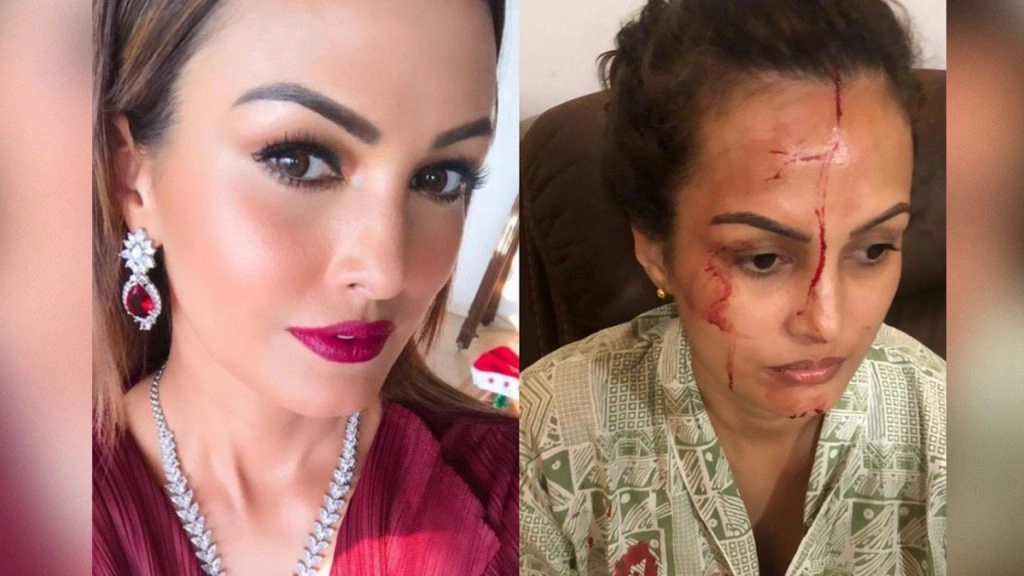 करण मेहरा संग झगड़े के चलते निशा रावल को लगी गंभीर चोट? एक्ट्रेस के सपोर्ट में उतरे सेलिब्रिटीज