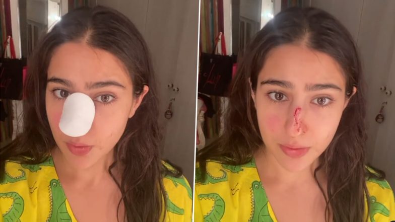 Sara Ali Khan की नाक से बह रहा था खून, वीडियो शेयर करके अम्मा-अब्बा से मांगी माफी