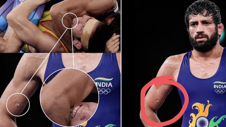 Tokyo Olympics: गोल्ड से एक कदम दूर रवि दहिया, सेमीफाइनल में दर्द के बावजूद नहीं डिगा साहस- वीरेंद्र सहवाग ने भी की तारीफ