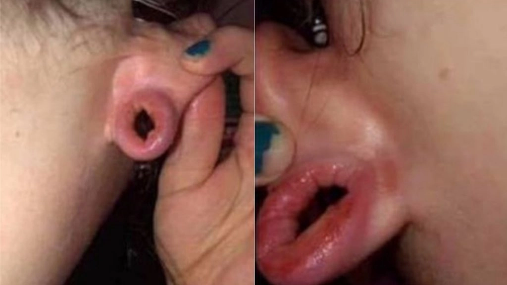 संबंध बनाते समय लड़के ने किया कुछ ऐसा कि लड़की इयरलोब को हुआ नुकसान, अब लोगों से मांग रही है सलाह