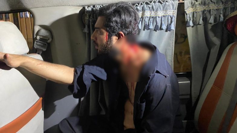 Pakistan: खुफिया अधिकारियों ने पत्रकारों के प्राइवेट पार्ट को दिए बिजली के झटके, सर फोड़ा... बस की थी सच बोलने की गलती