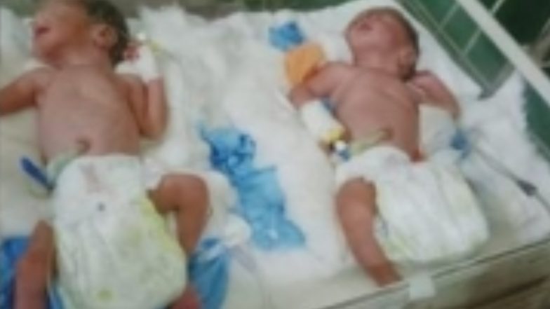 Bihar: बिहार में परिवार को मिली चौगुनी खुशी, महिला ने एक साथ दिया 4 बच्चों को जन्म