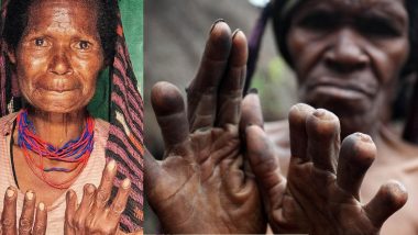 Shocking: परिजनों की मौत पर महिलाएं काट लेती हैं अपनी उंगलियां! इस जनजाति की है अजीब मान्यता