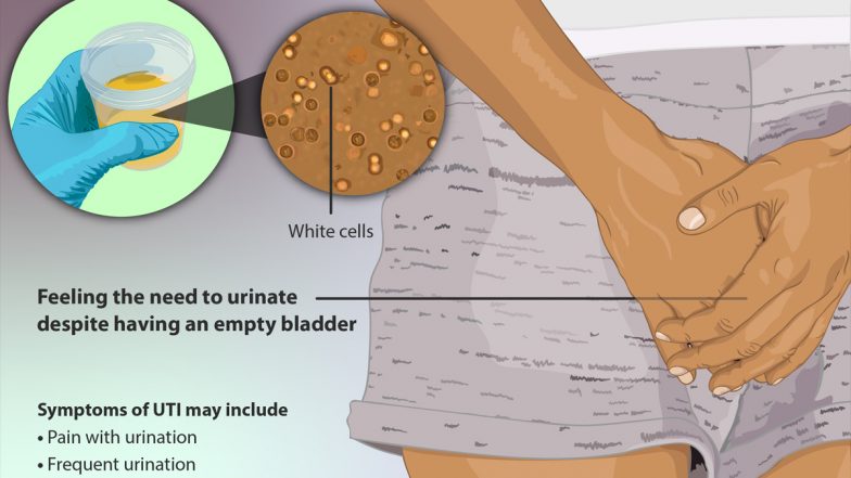 Urine Infections in Summer 2022: गर्मी में युरिन संक्रमण की समस्या से कैसे बचें? जानें ये 7 लाभकारी नुस्खे!