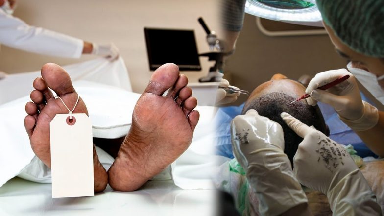 Patna: हेयर ट्रांसप्लांट के बाद कांस्टेबल की हार्ट अटैक से मौत, 11 मई को होनी थी शादी, डॉक्टर व नर्सिग स्टाफ फरार