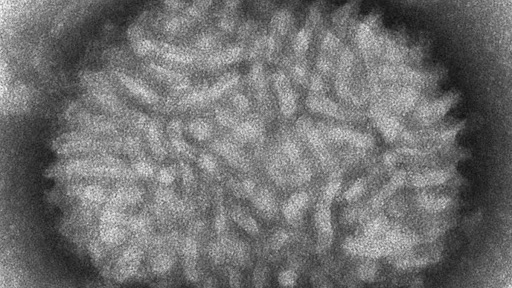 Monkeypox: इंग्लैंड में मंकीपॉक्स वायरल संक्रमण के दो और मामलों की पुष्टि, यहां पढ़ें इस बीमारी के लक्षण