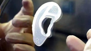 3D Printer Ears: पहली बार महिला को लगाया गया 3D प्रिंटेड कान, उसकी ही कोशिका से तैयार किया गया अंग