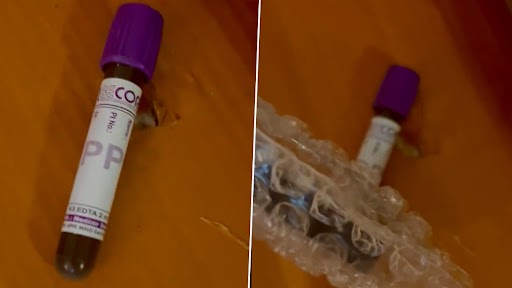 महिला ने Amazon से ऑर्डर की कुर्सी, साथ में मिला खून से भरा ब्लड कलेक्शन ट्यूब, देखें वीडियो