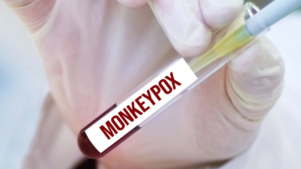 डरा रहा है Monkeypox, केंद्र ने आज बुलाई टॉप हेल्थ एक्सपर्ट्स की बैठक