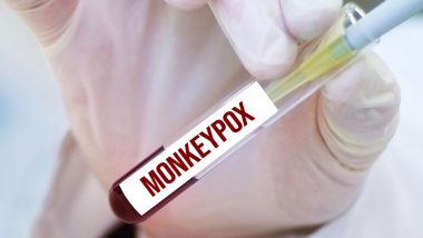 Monkeypox In US: अमेरिका में तेजी से पैर पसार रहा है मंकीपॉक्स वायरस, सहम गए लोग, राष्ट्रपति Biden ने घोषित की Health Emergency