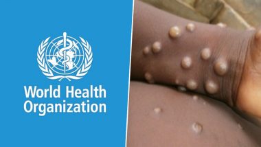 Monkeypox Outbreak: दुनिया में बढ़ा मंकीपॉक्स का खतरा, WHO ने ग्लोबल हेल्थ इमरजेंसी घोषित किया