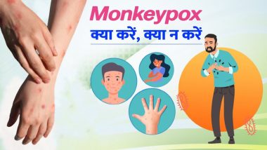 Monkeypox: क्या मंकीपॉक्स से समलैंगिक लोगों को है ज्यादा खतरा? जानें-इसके कारण, लक्षण, बचाव और उपचार