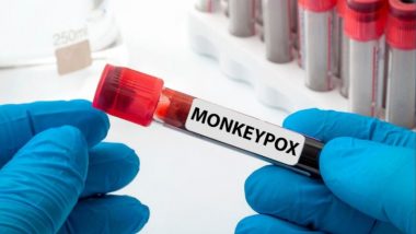 Monkeypox: क्या सेक्स करने से भी फैल सकता है मंकीपॉक्स? एक नए अध्ययन में हुआ चौंकाने वाला खुलासा