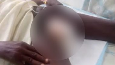 Man Accidentally Chops off his Own Penis: सपने में बकरी काटने के दौरान शख्स ने गलती से काट दिए अपने लिंग, देखें वीडियो