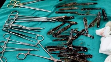 Spoons Removed From Man Stomach: मुज़फ्फरनगर में मरीज के पेट से ऑपरेशन कर निकाले गए 63 चम्मच, डॉक्टर भी हैरान