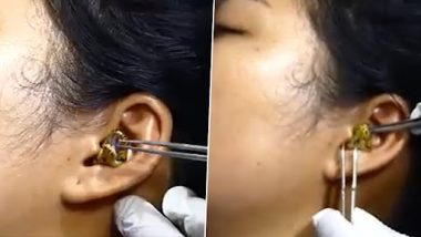 Snake in Ear: लड़की के कान में घुसा सांप, डॉक्टर ने की निकालने की कोशिश, उसके बाद जो हुआ...देखें वीडियो