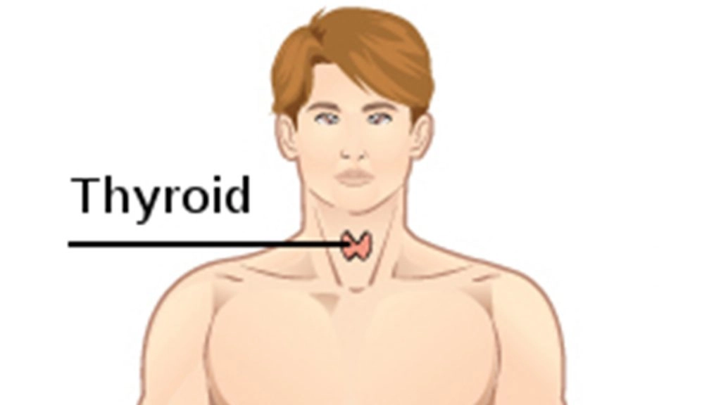 दिल्ली के अस्पताल में एक व्यक्ति की थाइरॉयड ग्रंथि से निकाला गया “नारियल के आकार” का ट्यूमर