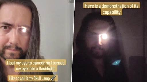 अपनी एक आंख कैंसर से खोने के बाद शख्स ने इसे बनाया टॉर्च, देखें वायरल वीडियो