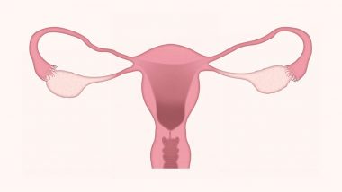 Hysterectomy Trend in Women: महिलाओं में गर्भाशय निकलवाने का चल रहा ट्रेंड, स्वास्थ्य विशेषज्ञ ने जताई चिंता