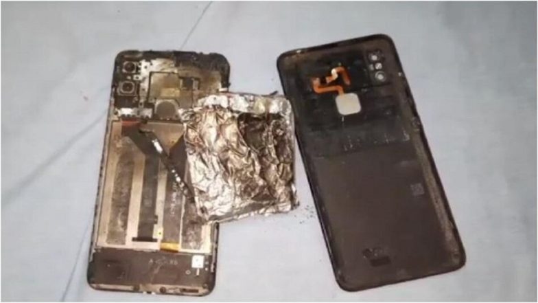 Mobile Blast: गेम खेलते समय हाथ में फटा मोबाइल, बच्चे का चेहरा और पेट बुरी तरह झुलसा