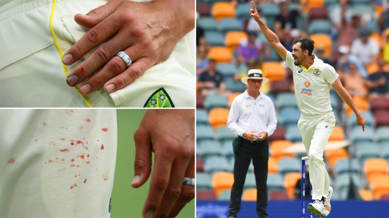 Aus vs SA 2nd Test: चोटिल होने के बाद भी मिचेल स्टार्क ने की गेंदबाजी, उंगली से निकला खून (देखें तस्वीर)
