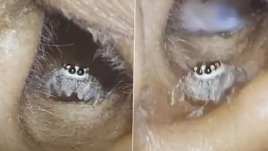 Spider Found in Woman's Ear: महिला के कान में घुसकर मकड़ी ने बुने जाले, भयावह वीडियो वायरल