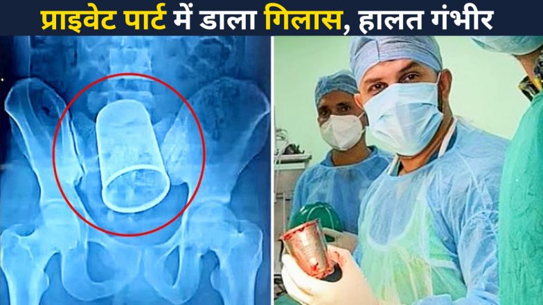 Glass in Private Part: मारपीट के बाद दामाद के प्राइवेट पार्ट में डाला गिलास, एक्सरे देखकर घबरा गए डॉक्टर