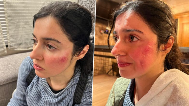 Divya Khosla Kumar को एक्शन सीक्वेंस के दौरान लगी चोट, एक्ट्रेस ने तस्वीरें शेयर करते हुए दी जानकारी (View Pics)