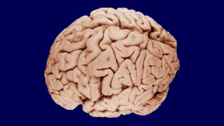 Alzheimer: इन कारणों से चली जाती है याददाश्त, चीजें भूलने लगते हैं लोग, वैज्ञानिकों ने बताई बड़ी वजह