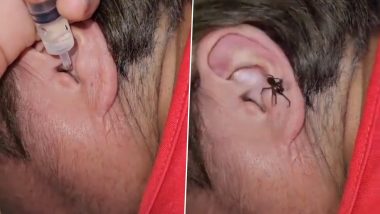 Viral Video: कान में घुसी मकड़ी तो उसे निकालने के लिए शख्स ने लगाया गजब का जुगाड़, वीडियो देख हो जाएंगे हैरान