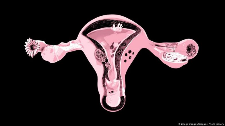 PCOS: क्या आप जानते हैं इस सिन्ड्रोम को?